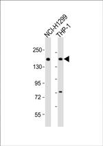 CaV2.1 Antibody in Western Blot (WB)