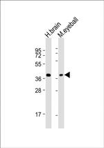 ARR3 Antibody in Western Blot (WB)