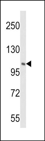 PI4KB Antibody in Western Blot (WB)