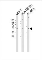 alpha-2b Adrenergic Receptor Antibody in Western Blot (WB)