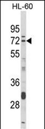 DTX4 Antibody in Western Blot (WB)