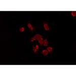 KISS1R Antibody in Immunocytochemistry (ICC/IF)