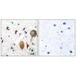 mGluR8 Antibody in Immunohistochemistry (Paraffin) (IHC (P))