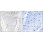 ALPK2 Antibody in Immunohistochemistry (Paraffin) (IHC (P))