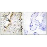 Laminin alpha-2 Antibody in Immunohistochemistry (Paraffin) (IHC (P))