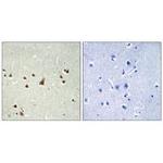 ANKRD26 Antibody in Immunohistochemistry (Paraffin) (IHC (P))