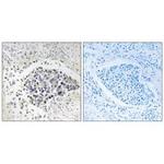 CPNE8 Antibody in Immunohistochemistry (Paraffin) (IHC (P))