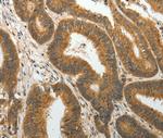 PTP4A2 Antibody in Immunohistochemistry (Paraffin) (IHC (P))