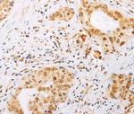 SPIN2 Antibody in Immunohistochemistry (Paraffin) (IHC (P))