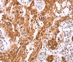 NCEH1 Antibody in Immunohistochemistry (Paraffin) (IHC (P))