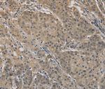 AGTRAP Antibody in Immunohistochemistry (Paraffin) (IHC (P))