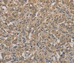 AGTRAP Antibody in Immunohistochemistry (Paraffin) (IHC (P))