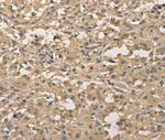 ALDH8A1 Antibody in Immunohistochemistry (Paraffin) (IHC (P))