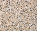 NAPSA Antibody in Immunohistochemistry (Paraffin) (IHC (P))