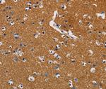 GPM6A Antibody in Immunohistochemistry (Paraffin) (IHC (P))