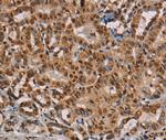 RBMX Antibody in Immunohistochemistry (Paraffin) (IHC (P))