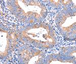 CMTM6 Antibody in Immunohistochemistry (Paraffin) (IHC (P))