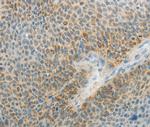 AGAP1 Antibody in Immunohistochemistry (Paraffin) (IHC (P))