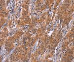 ARPC4 Antibody in Immunohistochemistry (Paraffin) (IHC (P))