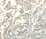 FZD8 Antibody in Immunohistochemistry (Paraffin) (IHC (P))