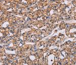 ARAP1 Antibody in Immunohistochemistry (Paraffin) (IHC (P))