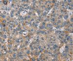 GINS1 Antibody in Immunohistochemistry (Paraffin) (IHC (P))