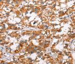 SLC4A1 Antibody in Immunohistochemistry (Paraffin) (IHC (P))