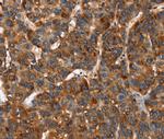 CACNB2 Antibody in Immunohistochemistry (Paraffin) (IHC (P))