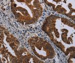 MAGEB3 Antibody in Immunohistochemistry (Paraffin) (IHC (P))