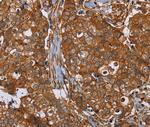 Plectin Antibody in Immunohistochemistry (Paraffin) (IHC (P))