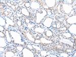 PPBP Antibody in Immunohistochemistry (Paraffin) (IHC (P))