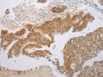 PPIL1 Antibody in Immunohistochemistry (Paraffin) (IHC (P))