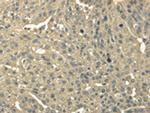 TRIB2 Antibody in Immunohistochemistry (Paraffin) (IHC (P))