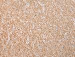 Dysferlin Antibody in Immunohistochemistry (Paraffin) (IHC (P))