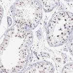 RFP2 Antibody in Immunohistochemistry (IHC)