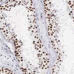 CSTF2 Antibody in Immunohistochemistry (IHC)