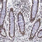 CSTF2 Antibody in Immunohistochemistry (IHC)