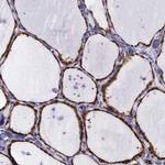 GMPR2 Antibody in Immunohistochemistry (IHC)