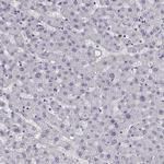 NPTXR Antibody in Immunohistochemistry (IHC)