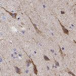 NPTXR Antibody in Immunohistochemistry (IHC)