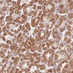 C14orf126 Antibody in Immunohistochemistry (IHC)