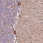 C14orf126 Antibody in Immunohistochemistry (IHC)