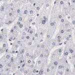 DGCR14 Antibody in Immunohistochemistry (IHC)