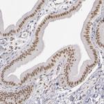 DGCR14 Antibody in Immunohistochemistry (IHC)