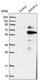 DGCR14 Antibody in Western Blot (WB)