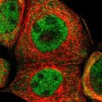 TRIB2 Antibody in Immunocytochemistry (ICC/IF)