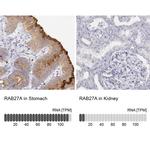 RAB27A Antibody in Immunohistochemistry (IHC)