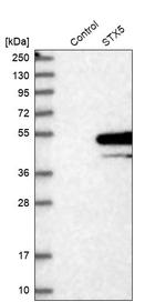 STX5 Antibody in Western Blot (WB)