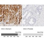 Carbonic Anhydrase II Antibody in Immunohistochemistry (IHC)