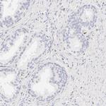 Carbonic Anhydrase II Antibody in Immunohistochemistry (IHC)